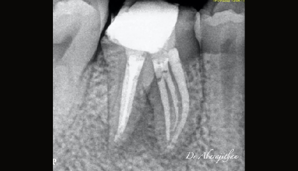 Dr. Abhrajithan-09